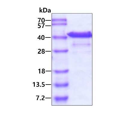 SDS-PAGE: Recombinant Human Bestrophin 1 His Protein [NBP2-53038]